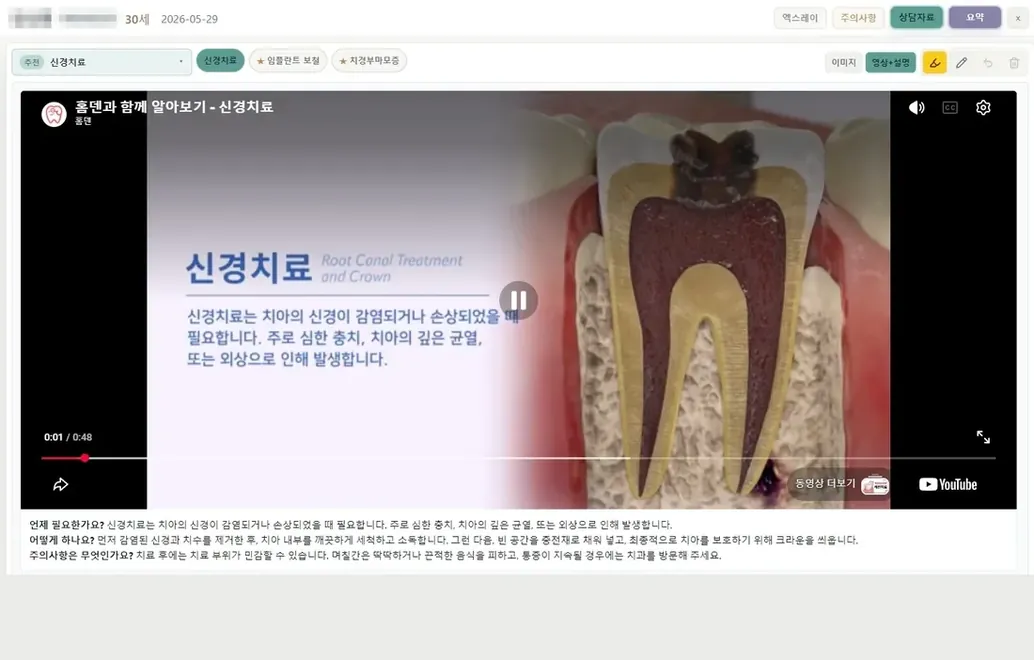 상담자료 화면 — 신경치료 설명 영상과 자동 추천 태그(임플란트 보철, 치경부마모증)