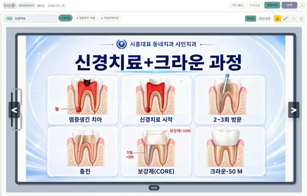 상담자료 화면 — 병원 커스텀 신경치료와 크라운 과정 인포그래픽